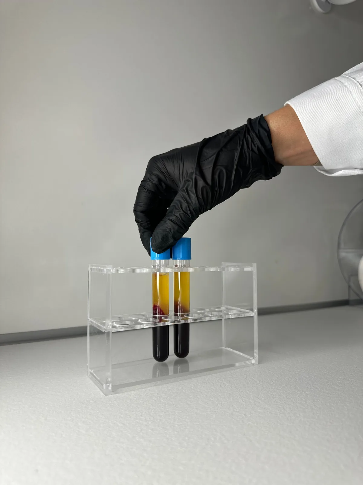 Representative pathology specimen tubes