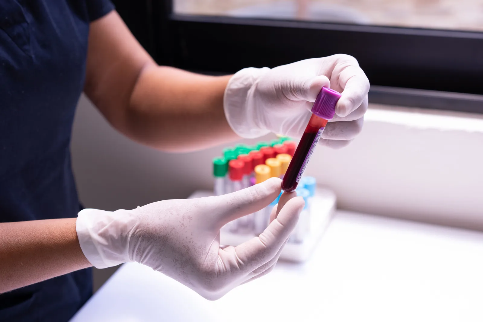 Representative clinical laboratory blood sample handling