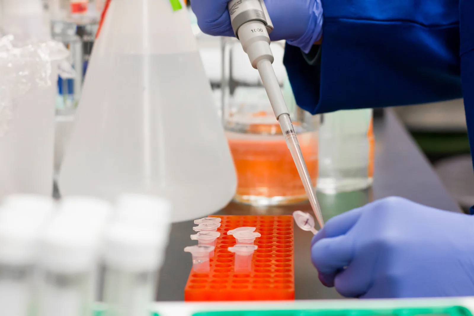 Representative laboratory pipette and sample handling