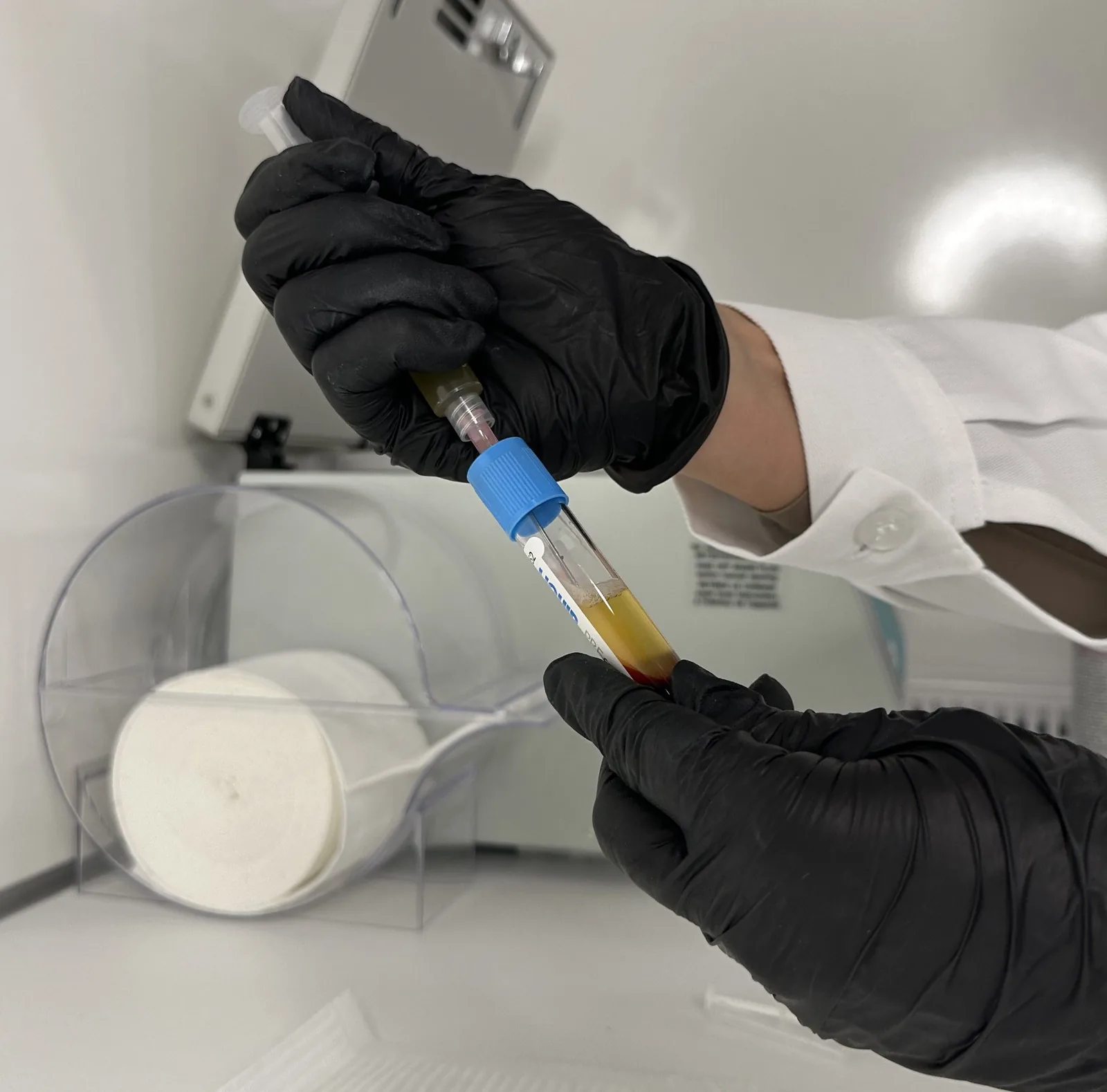 Laboratory professional handling a blood sample in a clinical laboratory